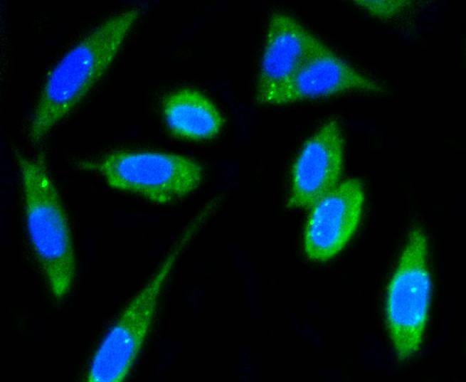Anti-PTK2 Antibody (4L758)