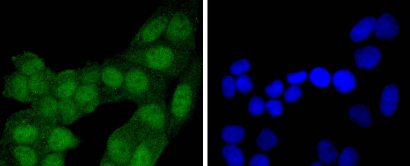 Anti-4EBP1 Antibody (5U577)