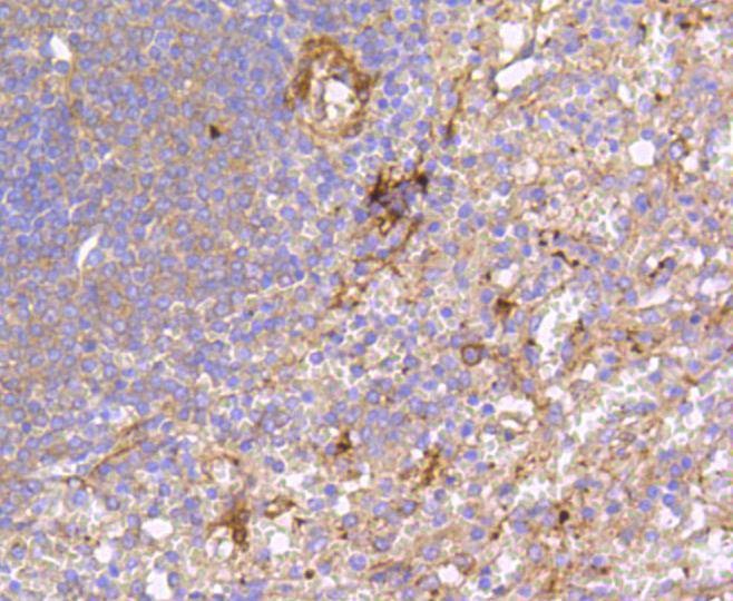 Anti-PTK2 Antibody (4L758)