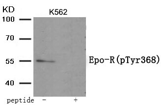 Anti-Phospho-EPOR (Tyr368) Polyclonal Antibody