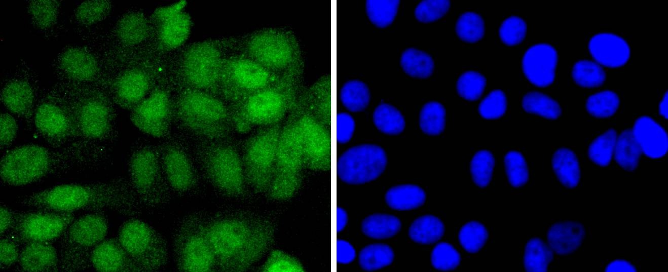 Anti-4EBP1 Antibody (5U577)