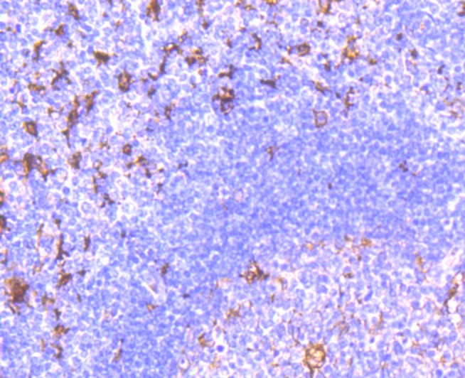 Anti-FSCN1 Antibody (7Z181)