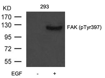 Anti-Phospho-PTK2 (Tyr397) Polyclonal Antibody