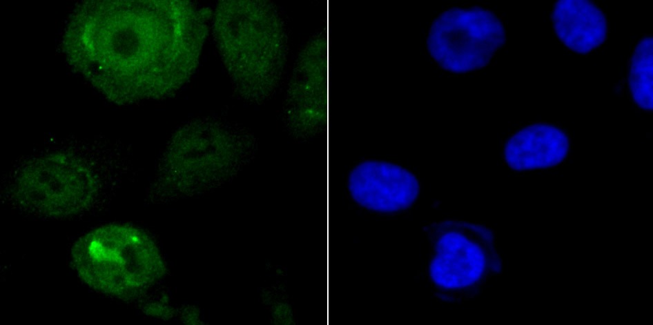 Anti-Endo G Antibody (1O411)