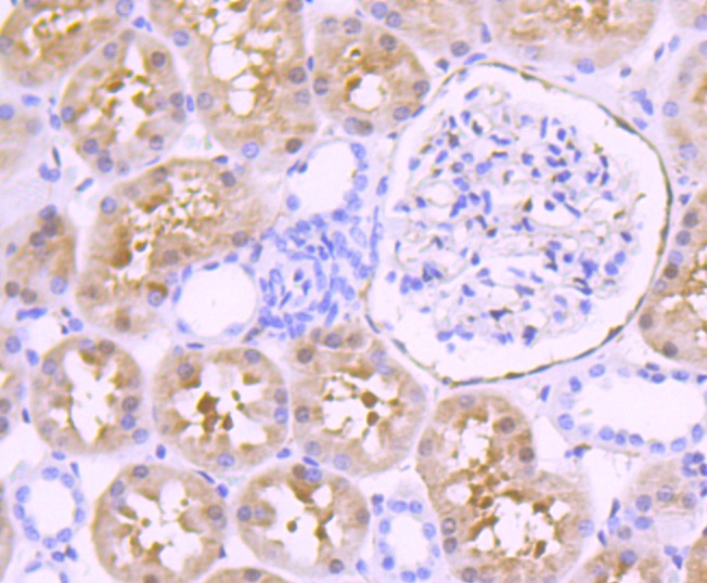Anti-FSCN1 Antibody (7Z181)