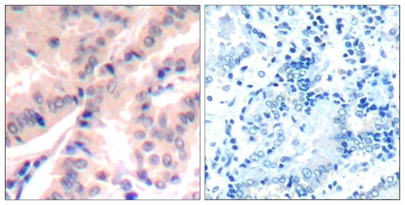 Anti-Phospho-eIF4B (Ser422) Polyclonal Antibody
