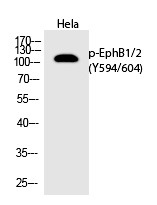 Anti-Phospho-EphB1/2 (Tyr594/604) Polyclonal Antibody
