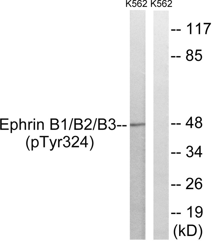 Anti-Phospho-Ephrin B1/2/3 (Tyr324) Polyclonal Antibody 2
