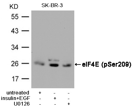 Anti-Phospho-EIF4E (Ser209) Polyclonal Antibody