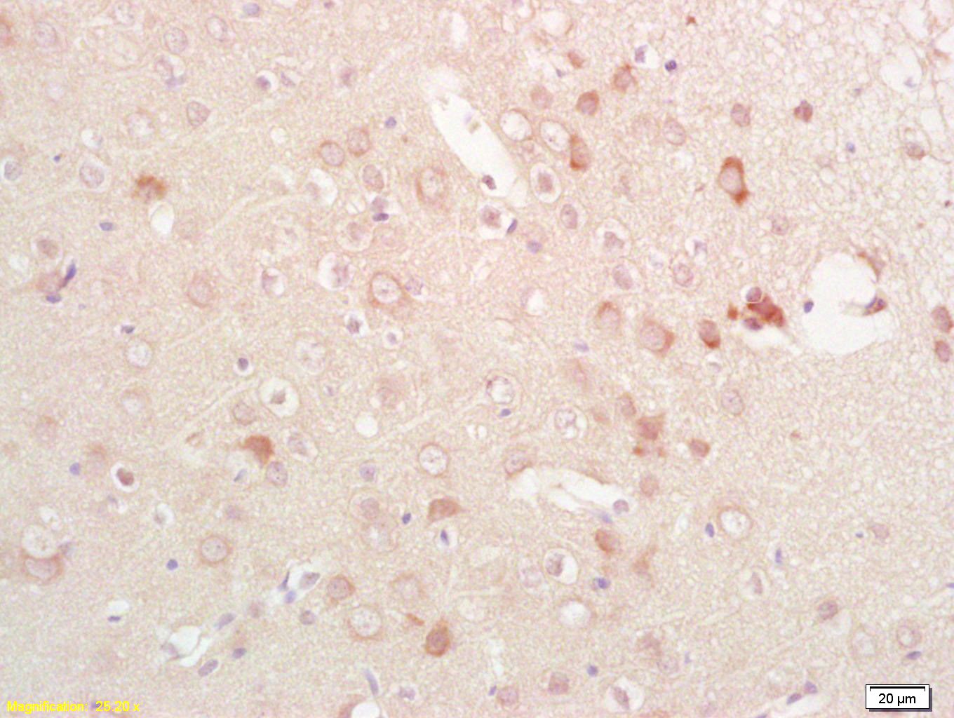 Anti-Phospho-EphB1 (Tyr928) Polyclonal Antibody
