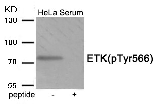 Anti-Phospho-Bmx (Tyr566) Polyclonal Antibody