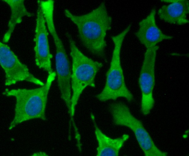 Anti-FSCN1 Antibody (7Z181)