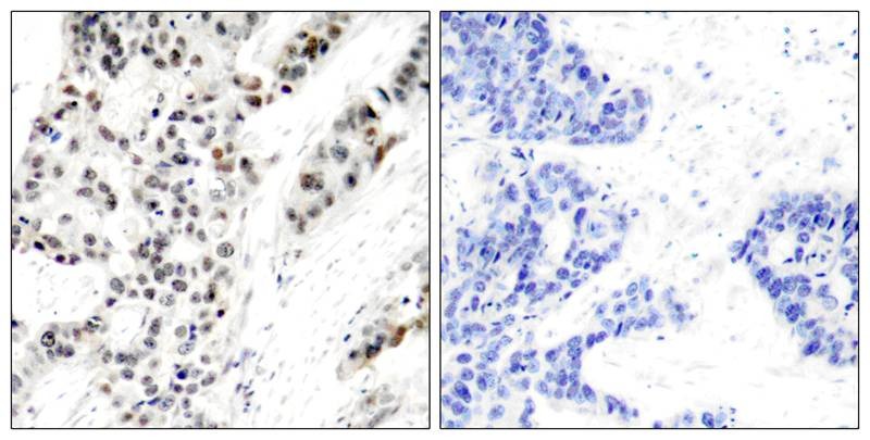 Anti-Phospho-ER alpha (Ser106) Polyclonal Antibody