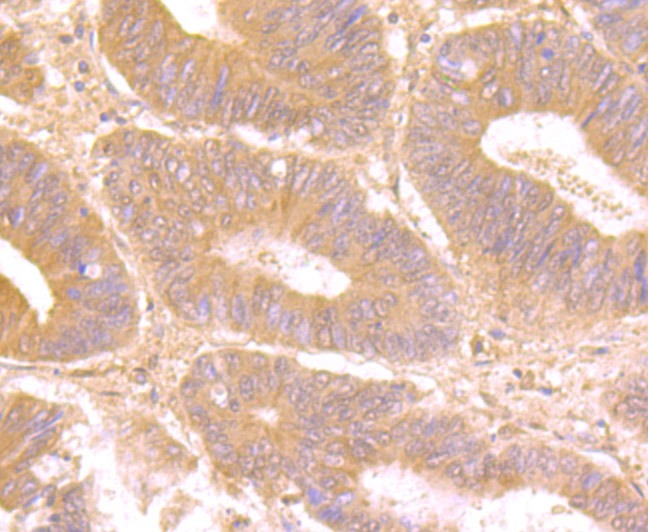 Anti-LGALS8 Antibody (3D467)