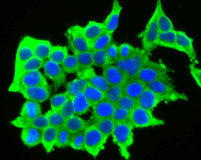 Anti-GABRA5 Antibody (3J289)