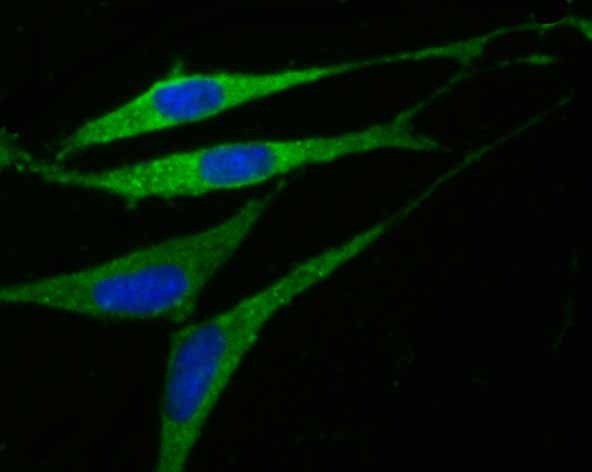 Anti-GABRA5 Antibody (3J289)