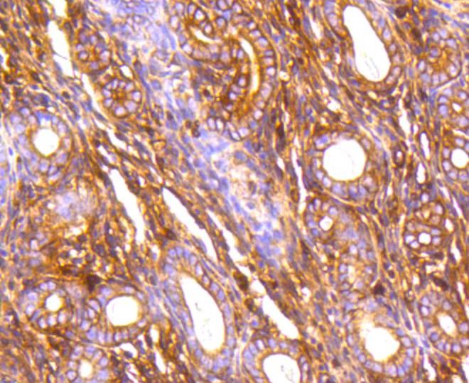 Anti-Filamin-A Antibody (7R224)
