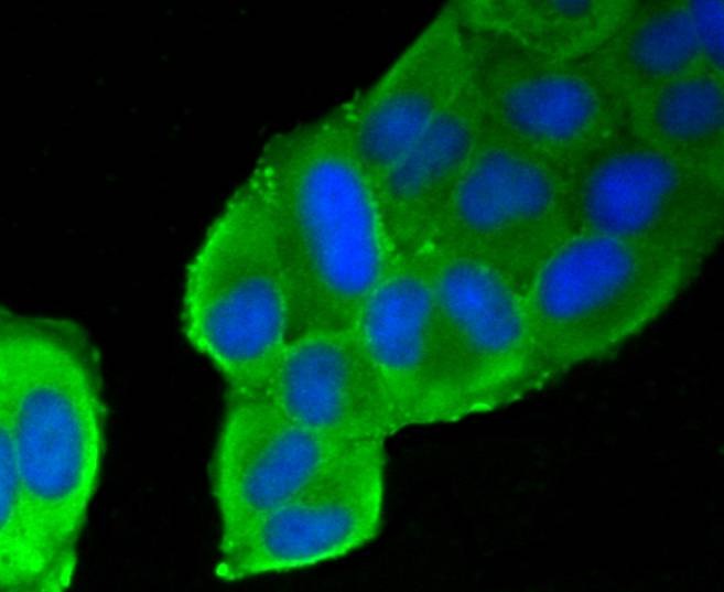 Anti-Filamin-A Antibody (7R224)