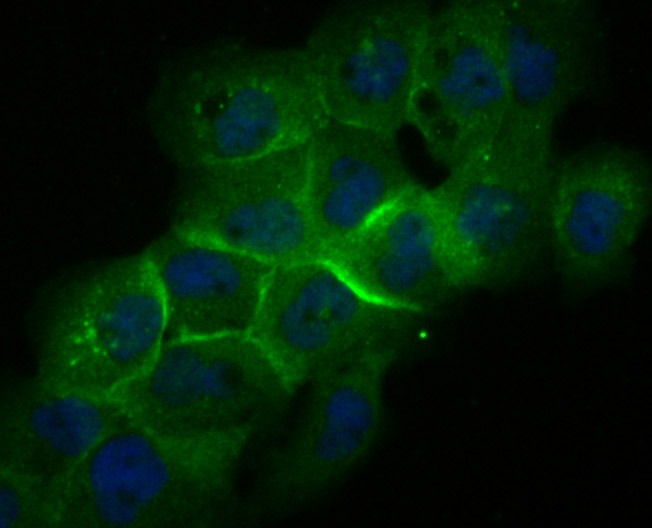 Anti-LGALS8 Antibody (3D467)