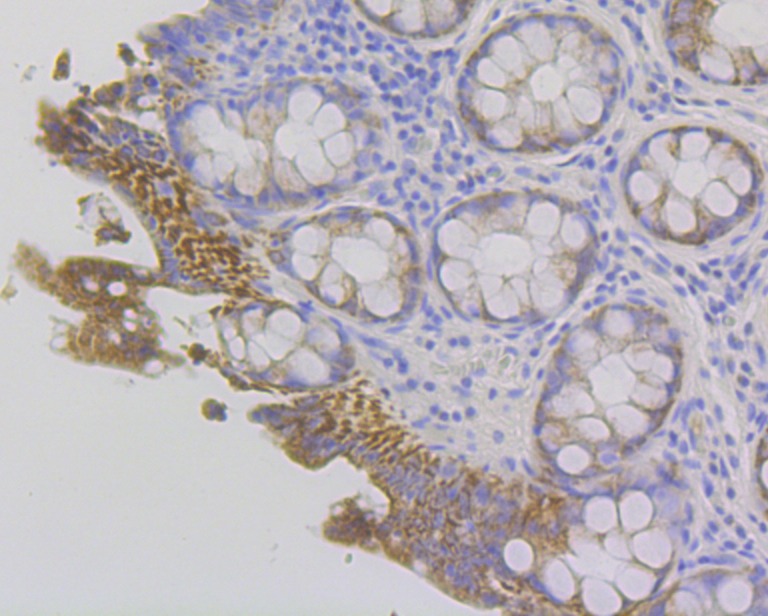 Anti-Fibrinogen Gamma Chain Antibody (1N94)