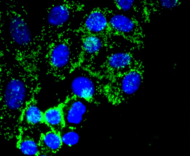 Anti-Fibronectin Antibody (8K938)