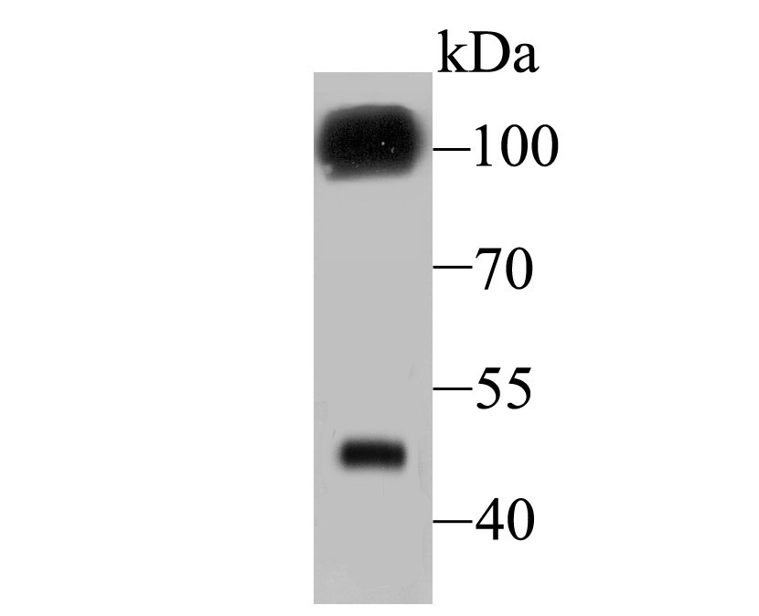 Anti-GABA B Receptor 2 Antibody (7M355)