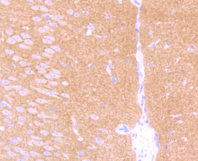 Anti-GABA B Receptor 2 Antibody (7M355)