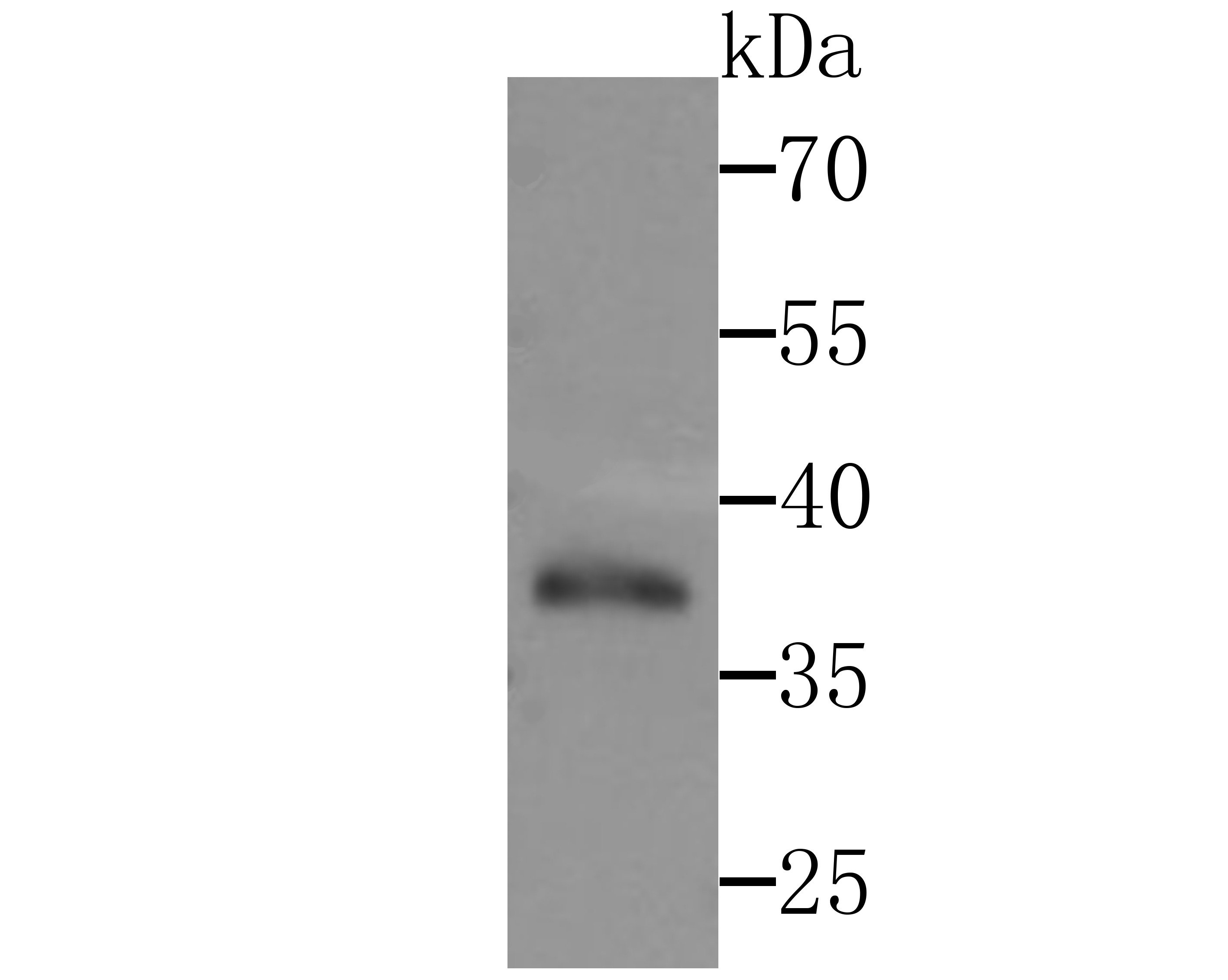 Anti-DNA PolymeraseBeta Antibody (2R73)