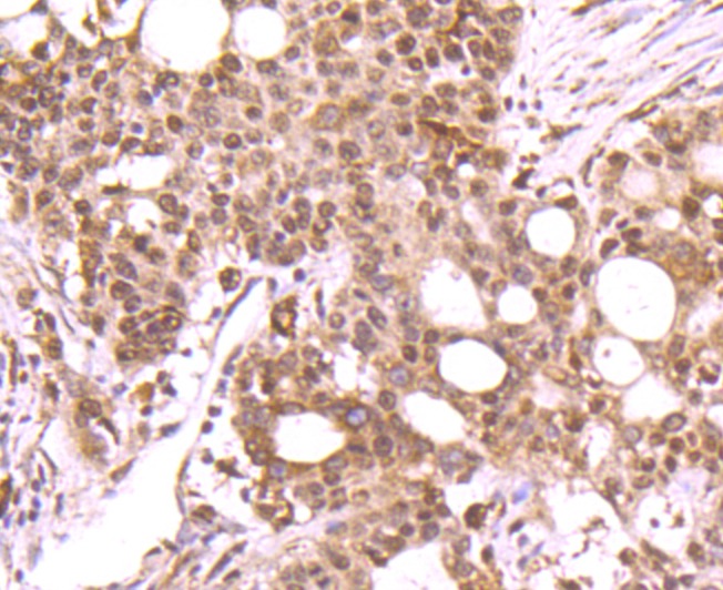 Anti-DNA PolymeraseBeta Antibody (2R73)
