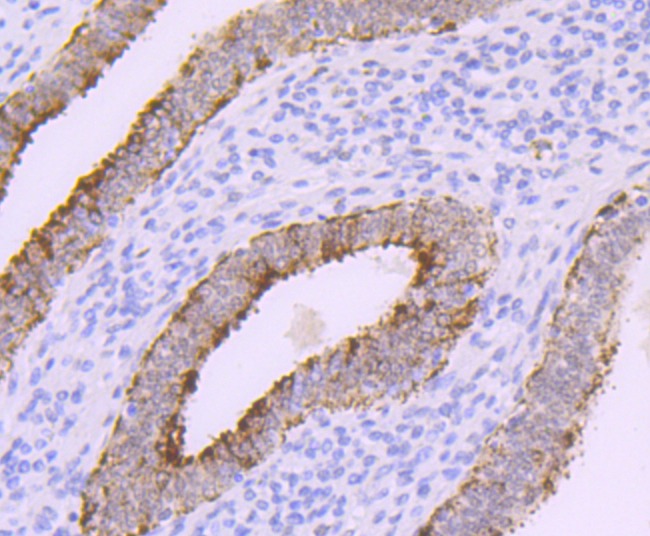Anti-DNA PolymeraseBeta Antibody (2R73)