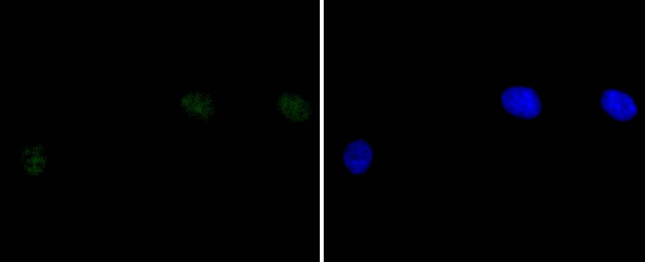 Anti-PRKDC Antibody (5G885)