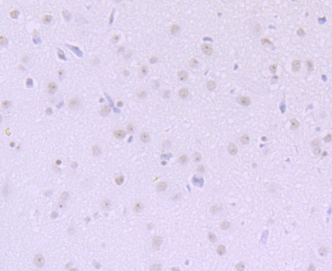Anti-DKC1 Antibody (9U209)