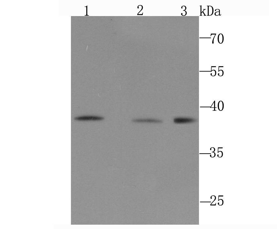 Anti-DNA PolymeraseBeta Antibody (2R73)