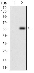 Anti-DIS3L2 Antibody (3M441)