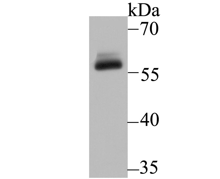 Anti-DKC1 Antibody (9U209)