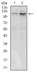 Anti-DIS3L2 Antibody (3M441)