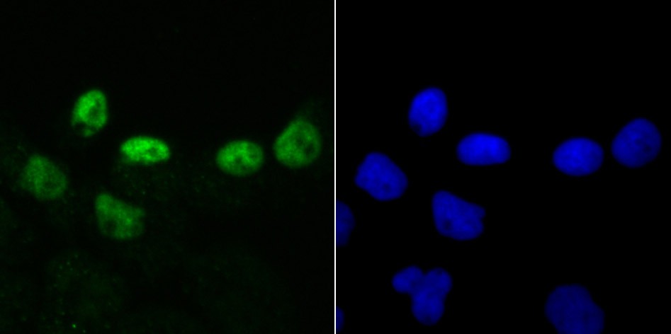 Anti-DKC1 Antibody (9U209)