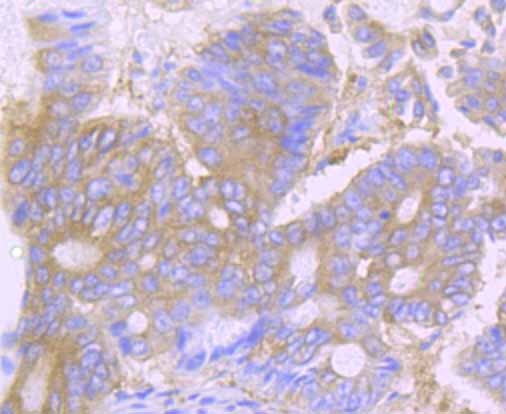 Anti-DSG1 Antibody (4J92)