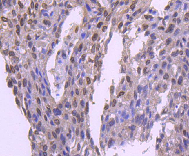 Anti-E2F1 Antibody (2K279)