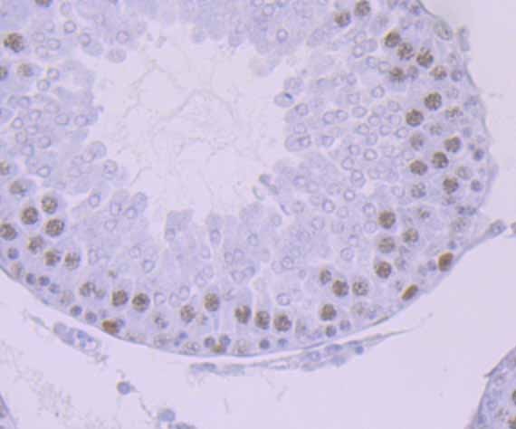 Anti-LIG1 Antibody (7P159)