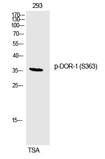 Anti-Phospho-OPRD1 (Ser363) Polyclonal Antibody