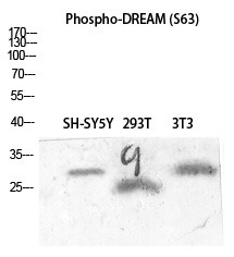 Anti-Phospho-CSEN (Ser63) Polyclonal Antibody