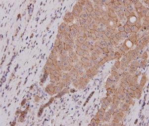 Anti-E-Cadherin/Cadherin-1 Antibody (7M374)
