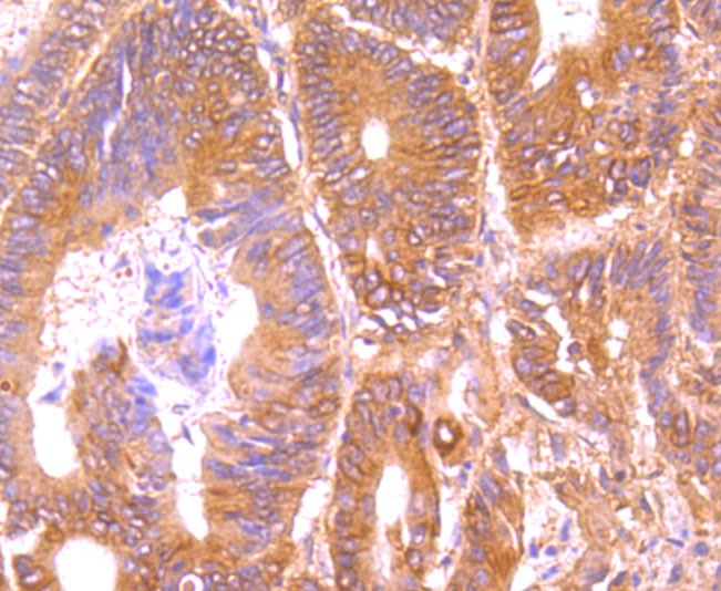 Anti-TRAIL R2/DR5/TNFRSF10B Antibody (7L7)