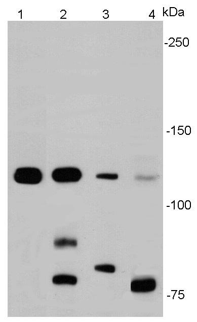 Anti-E-Cadherin/Cadherin-1 Antibody (7M374)
