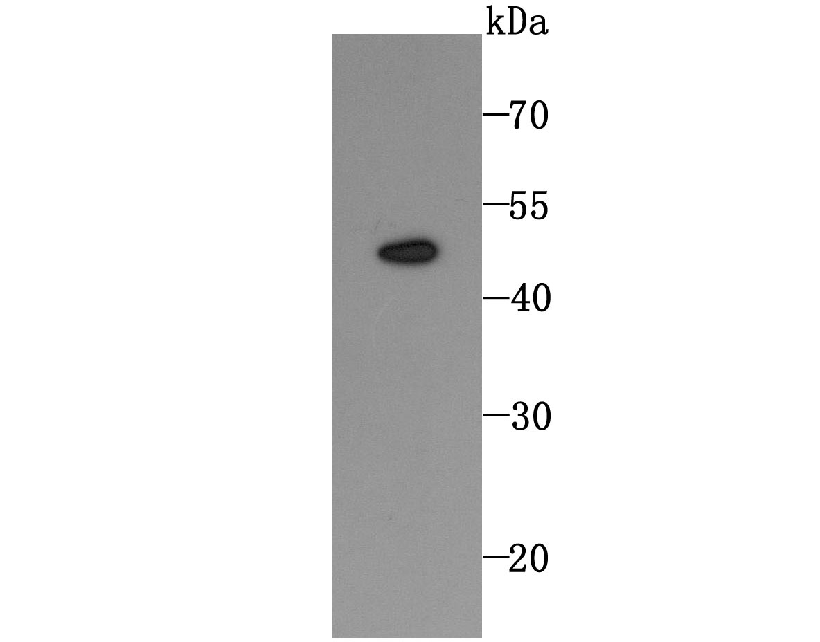 Anti-TRAIL R2/DR5/TNFRSF10B Antibody (7L7)
