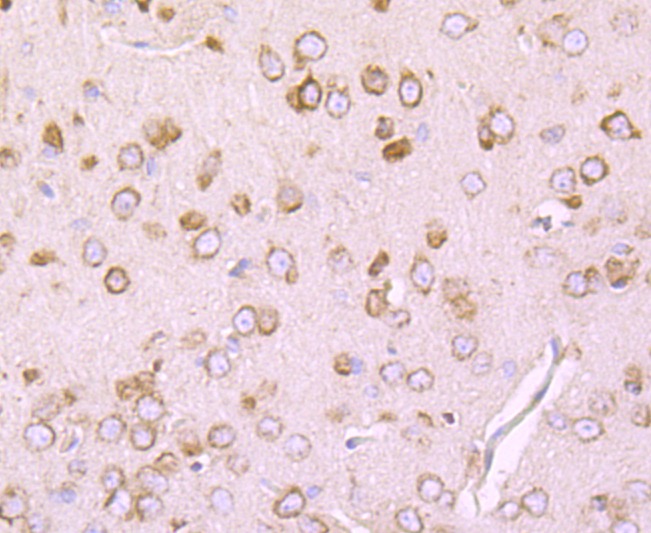 Anti-DRD1 Antibody (5S403)
