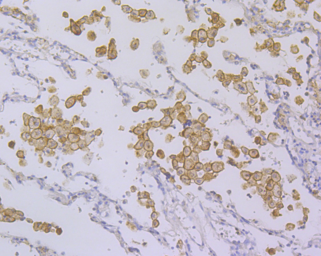 Anti-DAP12 Antibody (2G400)