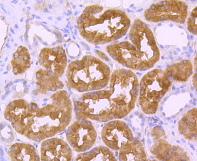 Anti-NHERF1 Antibody (1A168)