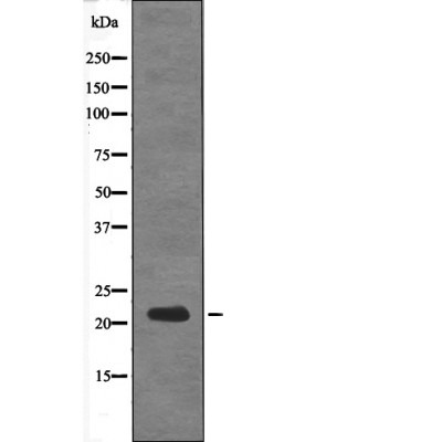 Anti-Phospho-DSCR1 (Ser108) Polyclonal Antibody